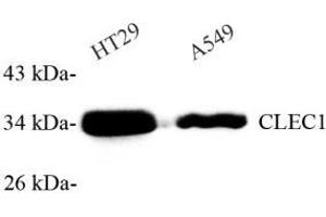 Western blot analysis of CLEC1 (ABIN7073246) at dilution of 1: 1000 (CLEC1A anticorps)