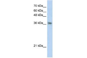 WB Suggested Anti-PHYHIP Antibody Titration:  0. (PHYHIP anticorps  (N-Term))