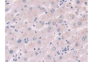 Detection of NQO1 in Human Liver Tissue using Polyclonal Antibody to NADH Dehydrogenase, Quinone 1 (NQO1)