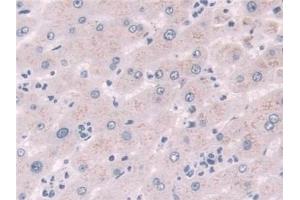 Detection of NQO1 in Human Liver Tissue using Polyclonal Antibody to NADH Dehydrogenase, Quinone 1 (NQO1) (NQO1 anticorps  (AA 2-274))