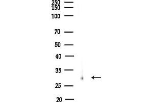 anti-rho GDP Dissociation Inhibitor (GDI) gamma (ARHGDIG) (Internal Region) antibody