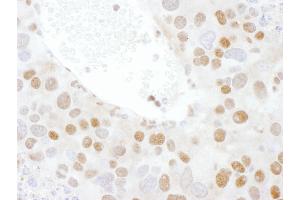 Immunohistochemistry (IHC) image for anti-TAR DNA Binding Protein (TARDBP) (AA 250-300) antibody (ABIN7454906)