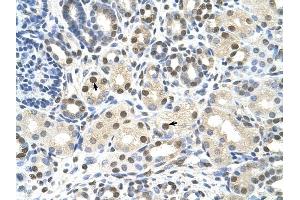 CACNB1 antibody was used for immunohistochemistry at a concentration of 4-8 ug/ml to stain Epithelial cells of renal tubule (arrows) in Human Kidney. (CACNB1 anticorps  (Middle Region))