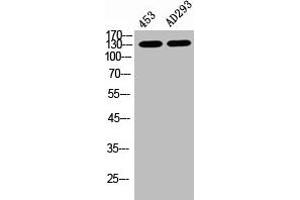 Western Blot analysis of 453 AD293 cells using Phospho-PERK (T981) Polyclonal Antibody (PERK anticorps  (pThr981))