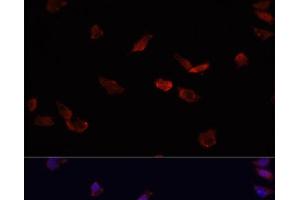 Immunofluorescence analysis of HeLa cells using BMPR2 Polyclonal Antibody at dilution of 1:100. (BMPR2 anticorps)