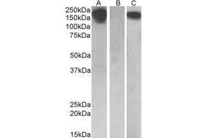 Western Blotting (WB) image for anti-Colony Stimulating Factor 1 Receptor (CSF1R) (Internal Region) antibody (ABIN2464715) (CSF1R anticorps  (Internal Region))