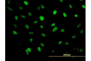 Immunofluorescence of monoclonal antibody to ZFHX1B on HeLa cell. (ZEB2 anticorps  (AA 1115-1214))