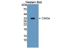 Detection of Recombinant PAPPA, Human using Polyclonal Antibody to Pregnancy Associated Plasma Protein A (PAPPA)