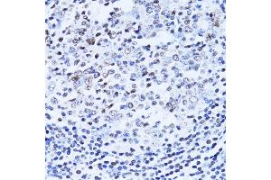 Immunohistochemistry of paraffin-embedded human vermiform appendix using PARP1 Antibody.