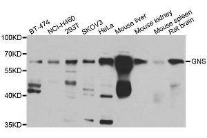 Western blot analysis of extracts of various cell lines, using GNS antibody. (GNS anticorps)