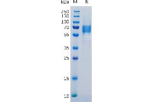 Human IL6R Protein, His Tag on SDS-PAGE under reducing condition.