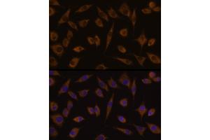 Immunofluorescence analysis of L929 cells using UGT1 Rabbit pAb (359) at dilution of 1:100 (40x lens). (UGT1A1 anticorps  (AA 1-200))