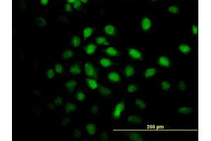 Immunofluorescence of monoclonal antibody to ALS2CR8 on HeLa cell. (Calcium Responsive Transcription Factor (CARF) (AA 621-718) anticorps)
