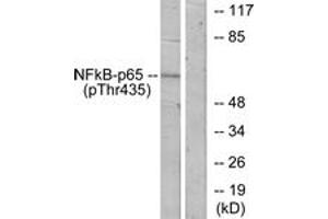 Western blot analysis of extracts from COS7 cells treated with TNF-alpha, using NF-kappaB p65 (Phospho-Thr435) Antibody. (NF-kB p65 anticorps  (pThr435))