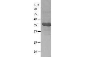 Western Blotting (WB) image for Small Ubiquitin Related Modifier 2 (SUMO2) (AA 1-93) protein (His-IF2DI Tag) (ABIN7125142)