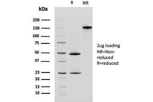 SDS-PAGE Analysis Purified CD10 Mouse Monoclonal Antibody (MME/2580).