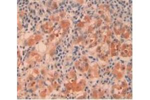 Detection of CTH in Human Kidney Tissue using Polyclonal Antibody to Cystathionine (CTH)