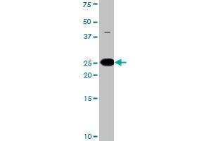 The BAD (phospho S134) polyclonal antibody  is used in Western blot to detect Phospho-BAD-S134 in HL-60 cell lysate. (BAD anticorps  (pSer170. pSer134))
