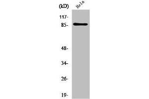 Western Blot analysis of HeLa cells using UTP14A Polyclonal Antibody (UTP14A anticorps  (Internal Region))