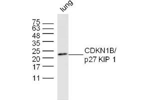Mouse lung lysates probed with CDKN1B Polyclonal Antibody, unconjugated  at 1:300 overnight at 4°C followed by a conjugated secondary antibody at 1:10000 for 60 minutes at 37°C. (CDKN1B anticorps  (AA 150-198))
