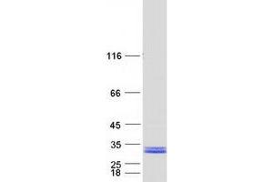 Validation with Western Blot