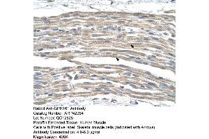 Rabbit Anti-GPR161 Antibody  Paraffin Embedded Tissue: Human Muscle Cellular Data: Skeletal muscle cells Antibody Concentration: 4. (GPR161 anticorps  (Middle Region))