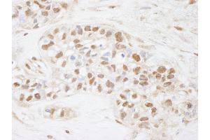 Immunohistochemistry (IHC) image for anti-Cell Division Cycle 25 Homolog C (S. Pombe) (CDC25C) (AA 150-200) antibody (ABIN7448466)