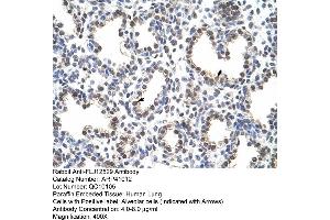 Rabbit Anti-FLJ12529 Antibody  Paraffin Embedded Tissue: Human Lung Cellular Data: Alveolar cells Antibody Concentration: 4.