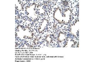 Rabbit Anti-FLJ12529 Antibody  Paraffin Embedded Tissue: Human Lung Cellular Data: Alveolar cells Antibody Concentration: 4. (CPSF7 anticorps  (C-Term))