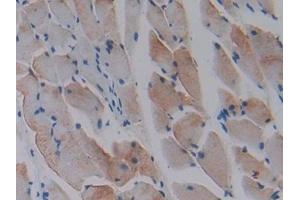 DAB staining on IHC-P; Samples: Mouse Skeletal muscle Tissue