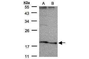 WB Image Sample(30 μg of whole cell lysate) A:HeLa S3, B:Hep G2, 12% SDS PAGE antibody diluted at 1:500 (SCN3B anticorps  (Center))