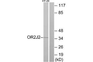 Western Blotting (WB) image for anti-Olfactory Receptor, Family 2, Subfamily J, Member 2 (OR2J2) (C-Term) antibody (ABIN1853218) (OR2J2 anticorps  (C-Term))
