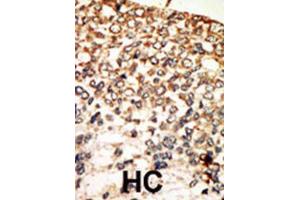 Immunohistochemistry (IHC) image for anti-PKA C-Alpha,PKA C-beta antibody (ABIN3002928) (PKA C-Alpha,PKA C-beta anticorps)