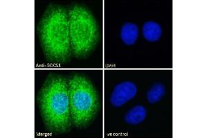 ABIN184575 Immunofluorescence analysis of paraformaldehyde fixed MCF7 cells, permeabilized with 0. (SOCS1 anticorps  (C-Term))