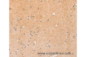 Immunohistochemistry of Human brain  using CCL16  Polyclonal Antibody at dilution of 1:50