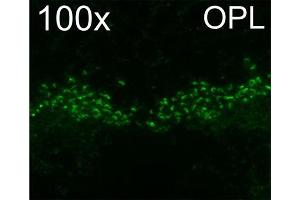 Indirect immunostaining of ribbon synapses in the outer plexiform layer of PFA mouse retina (dilution 1 : 1000).