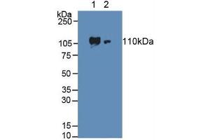 Western blot analysis of (1) Human HeLa cells and (2) Human Lung Tissue. (ADCY3 anticorps  (AA 501-736))