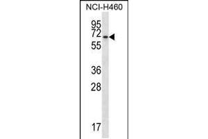 Western blot analysis in NCI-H460 cell line lysates (35ug/lane). (BEND4 anticorps  (N-Term))