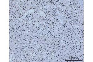 IHC analysis of HMGN2 using anti-HMGN2 antibody (ABIN6719576).