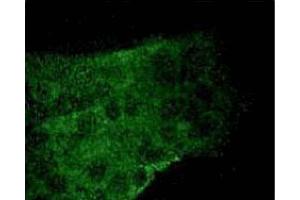 A431 cells were serum starved and treated with EGF (100 ng/ml) for 5 minutes, then fixed in 1:1 methanol-acetone for 10 minutes at -20°C.