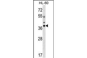 Western blot analysis in HL-60 cell line lysates (35ug/lane). (DLX5 anticorps  (AA 100-128))