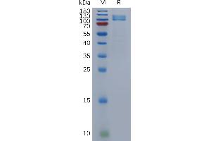 Human Protein, hFc Tag on SDS-PAGE under reducing condition.
