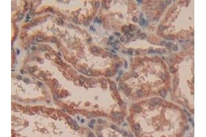 Detection of CASP3 in Human Kidney Tissue using Polyclonal Antibody to Caspase 3 (CASP3)