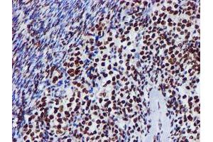 Image no. 2 for anti-Glutathione S-Transferase theta 2 (GSTT2) antibody (ABIN1498553) (GSTT2 anticorps)