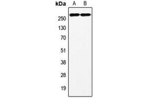 Western blot analysis of Factor VIII expression in HeLa (A), HepG2 (B) whole cell lysates. (Factor VIII anticorps  (C-Term))