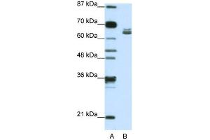 WB Suggested Anti-ZFP57 Antibody Titration:  1. (ZFP57 anticorps  (N-Term))