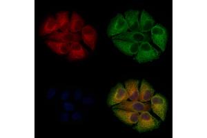 ABIN6262043 and ABIN6273250 staining Hela cells by IF/ICC. (GPD2 anticorps  (N-Term))
