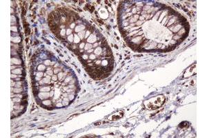 Image no. 6 for anti-B and T Lymphocyte Associated (BTLA) antibody (ABIN1496983) (BTLA anticorps)