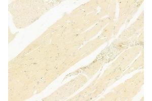 ABIN6264979 and ABIN6278126 at 1/100 staining human tongue carcinoma by IHC-P.