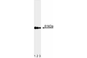 Western blot analysis of calcineurin. (CAN anticorps  (AA 349-505))